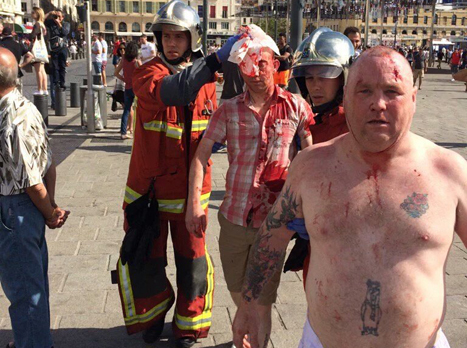 קרבות עקובים מדם במארסיי. תמונות פשוט מזעזעות